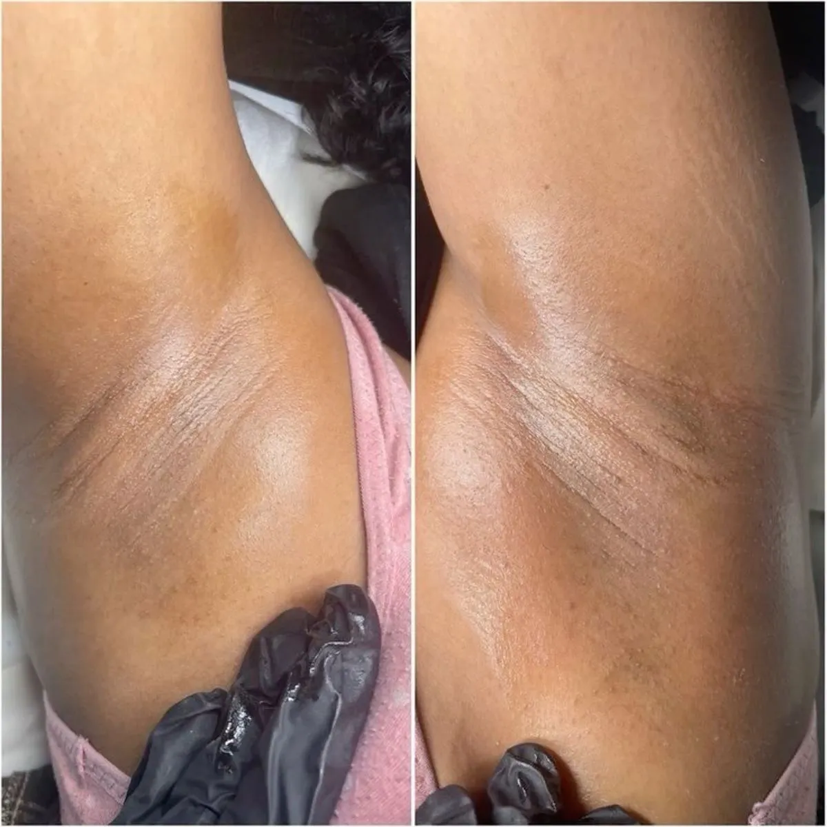 Armpit Waxing